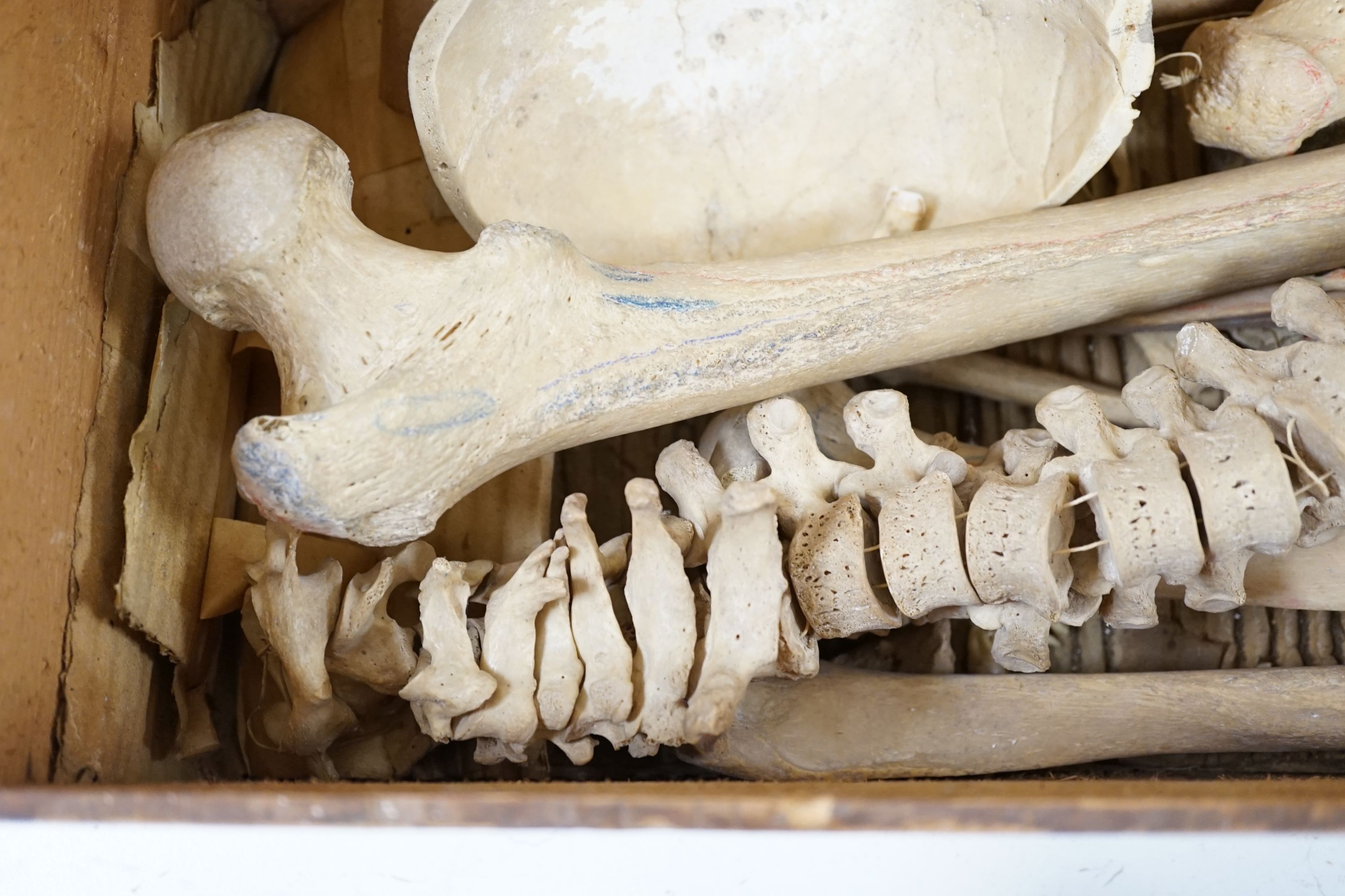An early 20th century human half-skeleton, in original retailer's box of Adam Rouilly & Co., 18 Fitzroy St London W1 (may not be complete)